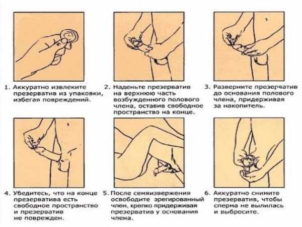 Схема использования презерватива